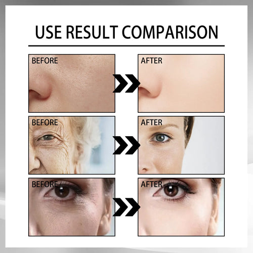 Creativity Snail Mucin